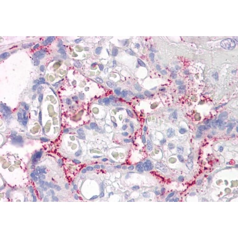 Immunohistochemistry - Anti-RAIN Antibody (A84037) - Antibodies.com