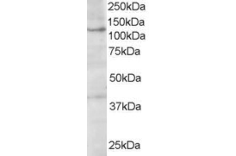 Western Blot - Anti-HPS3 Antibody (A84038) - Antibodies.com