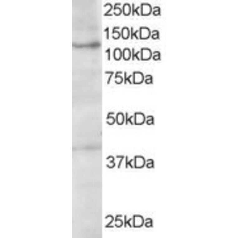 Western Blot - Anti-HPS3 Antibody (A84038) - Antibodies.com