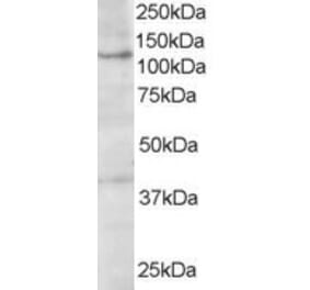 Western Blot - Anti-HPS3 Antibody (A84038) - Antibodies.com
