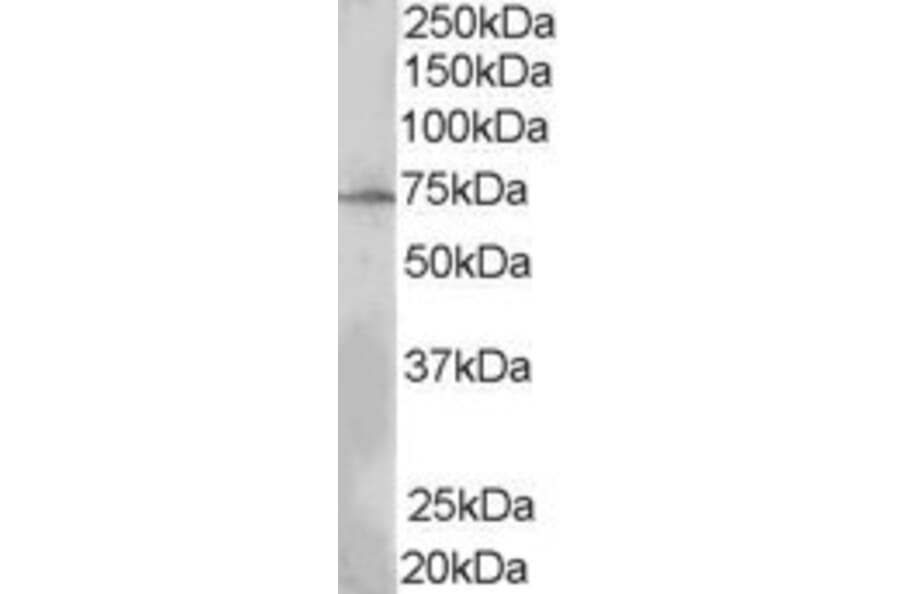 Western Blot - Anti-LNK Antibody (A84039) - Antibodies.com