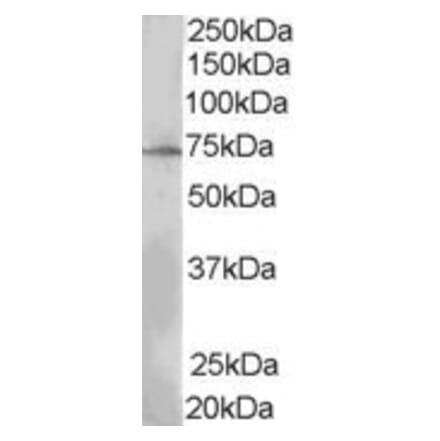 Western Blot - Anti-LNK Antibody (A84039) - Antibodies.com