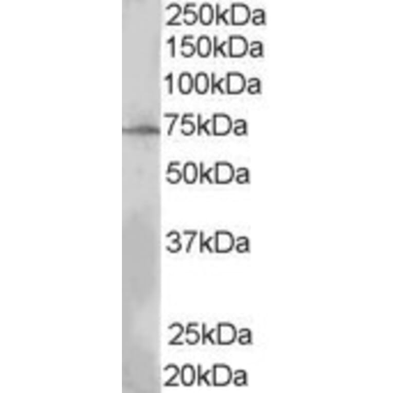 Western Blot - Anti-LNK Antibody (A84039) - Antibodies.com