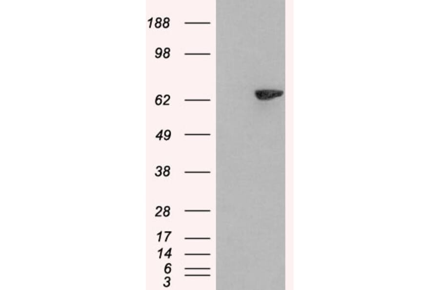 Western Blot - Anti-LNK Antibody (A84039) - Antibodies.com