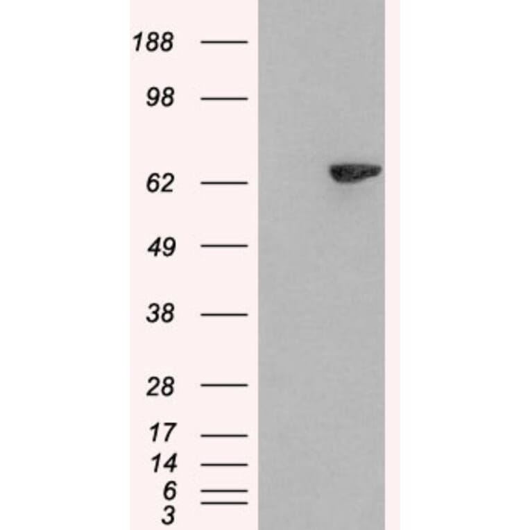 Western Blot - Anti-LNK Antibody (A84039) - Antibodies.com