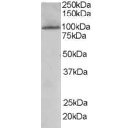 Western Blot - Anti-TAOK3 Antibody (A84040) - Antibodies.com