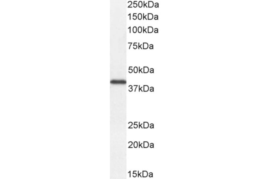 Western Blot - Anti-DKK1 Antibody (A84041) - Antibodies.com