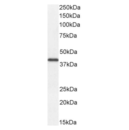 Western Blot - Anti-DKK1 Antibody (A84041) - Antibodies.com