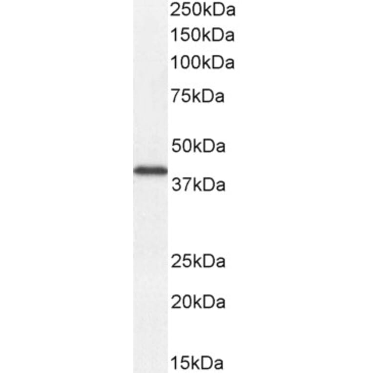 Western Blot - Anti-DKK1 Antibody (A84041) - Antibodies.com