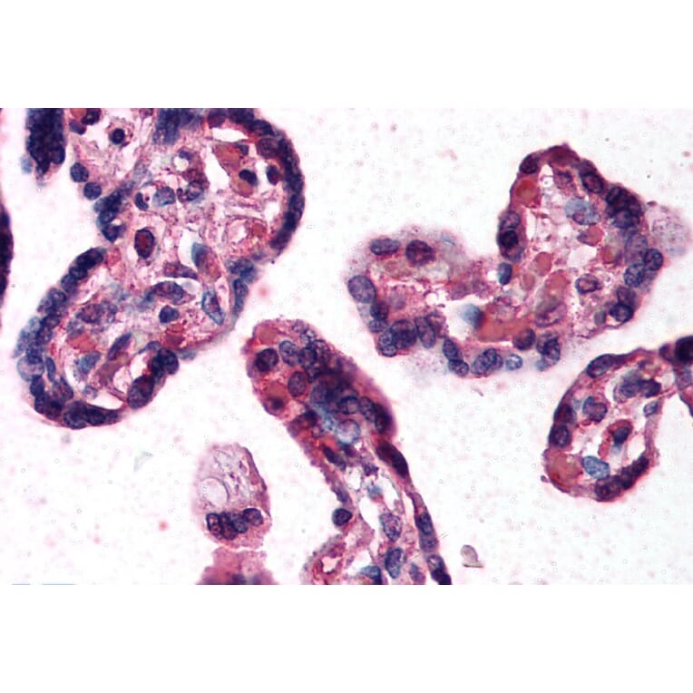 Immunohistochemistry - Anti-DKK1 Antibody (A84041) - Antibodies.com