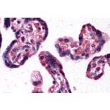 Immunohistochemistry - Anti-DKK1 Antibody (A84041) - Antibodies.com