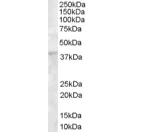 Western Blot - Anti-DKK1 Antibody (A84041) - Antibodies.com