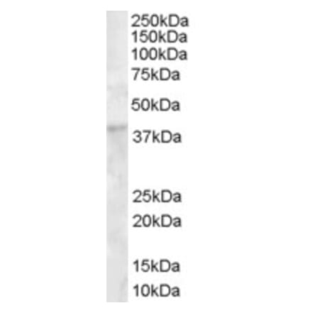 Western Blot - Anti-DKK1 Antibody (A84041) - Antibodies.com