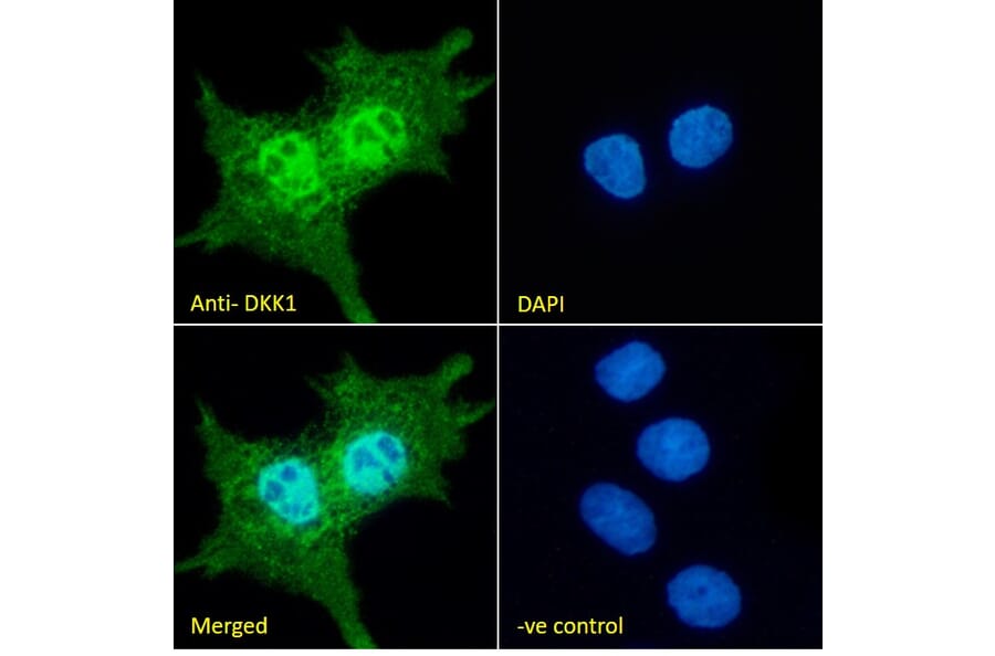 Immunofluorescence - Anti-DKK1 Antibody (A84041) - Antibodies.com