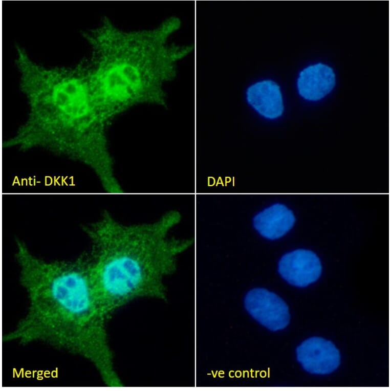 Immunofluorescence - Anti-DKK1 Antibody (A84041) - Antibodies.com