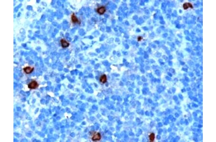 Immunohistochemistry - Anti-DOK5 Antibody (A84044) - Antibodies.com