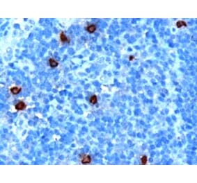 Immunohistochemistry - Anti-DOK5 Antibody (A84044) - Antibodies.com