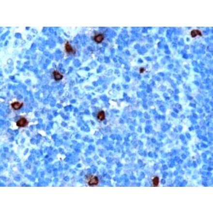 Immunohistochemistry - Anti-DOK5 Antibody (A84044) - Antibodies.com
