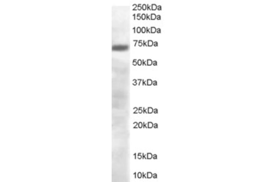 Western Blot - Anti-PRDM4/PFM1 Antibody (A84045) - Antibodies.com