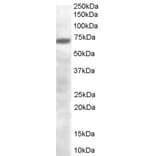 Western Blot - Anti-PRDM4/PFM1 Antibody (A84045) - Antibodies.com