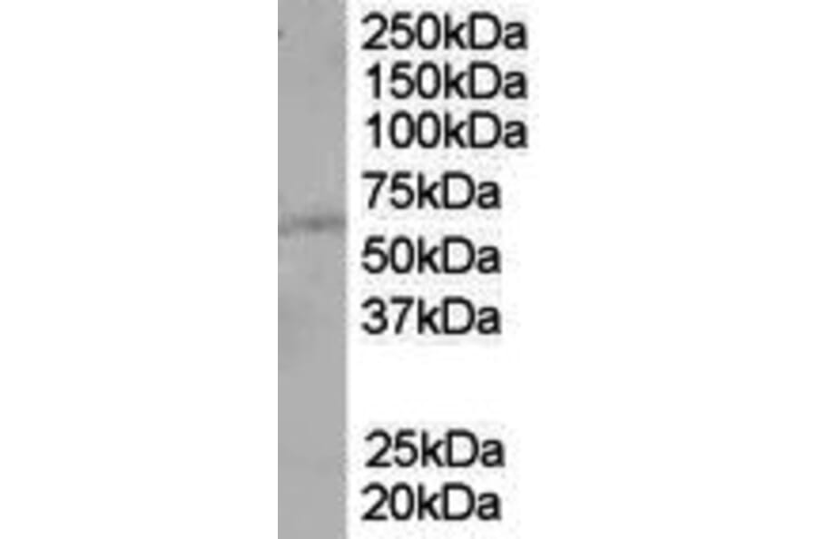 Western Blot - Anti-PTEN Antibody (A84047) - Antibodies.com