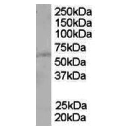 Western Blot - Anti-PTEN Antibody (A84047) - Antibodies.com