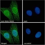 Immunofluorescence - Anti-PADI4/PAD4 Antibody (A84048) - Antibodies.com
