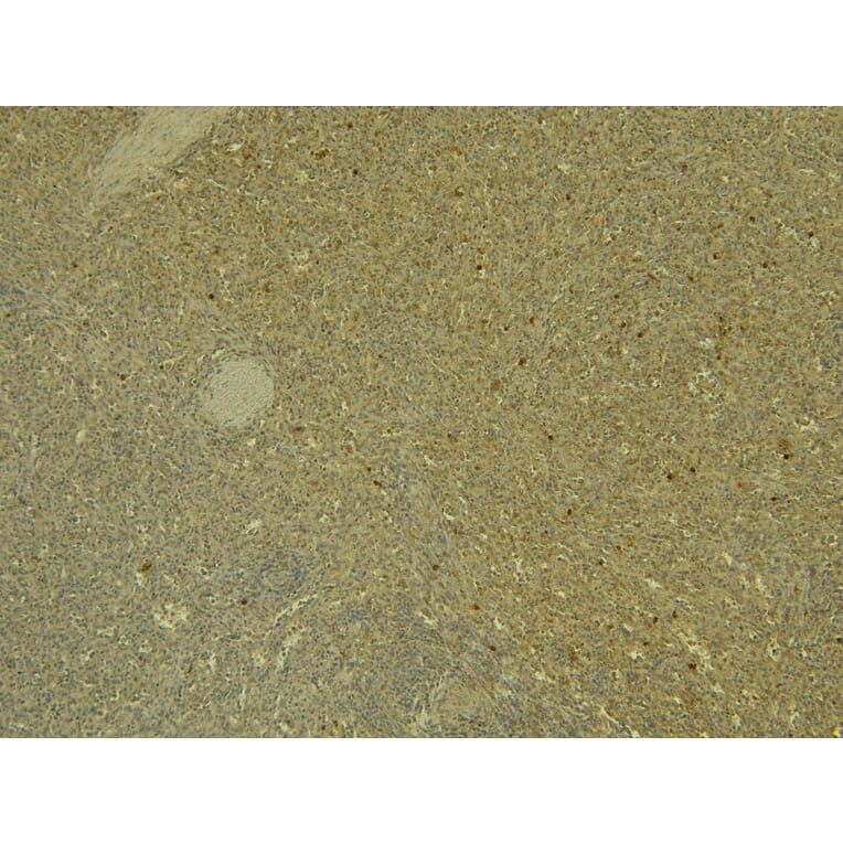 Immunohistochemistry - Anti-PADI4/PAD4 Antibody (A84048) - Antibodies.com