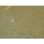 Immunohistochemistry - Anti-PADI4/PAD4 Antibody (A84048) - Antibodies.com