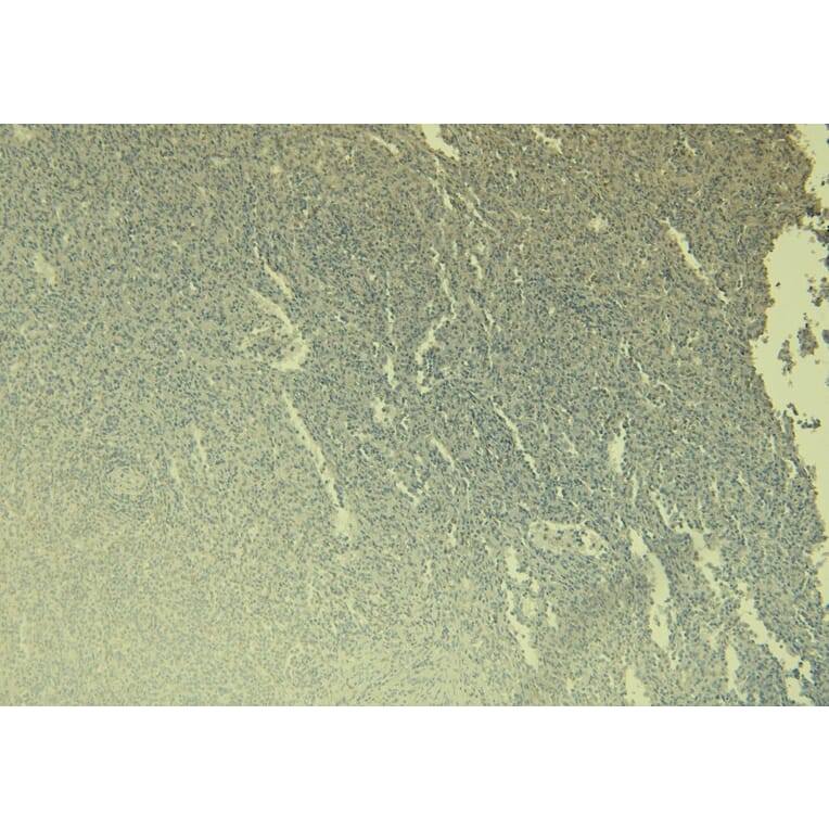 Immunohistochemistry - Anti-PADI4/PAD4 Antibody (A84048) - Antibodies.com