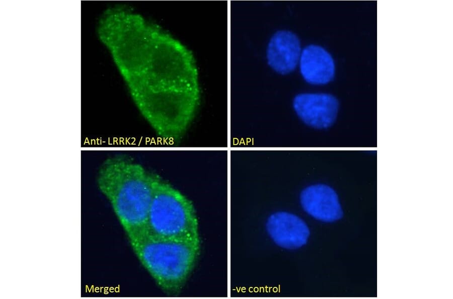 Immunofluorescence - Anti-LRRK2 Antibody (A84049) - Antibodies.com