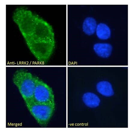 Immunofluorescence - Anti-LRRK2 Antibody (A84049) - Antibodies.com