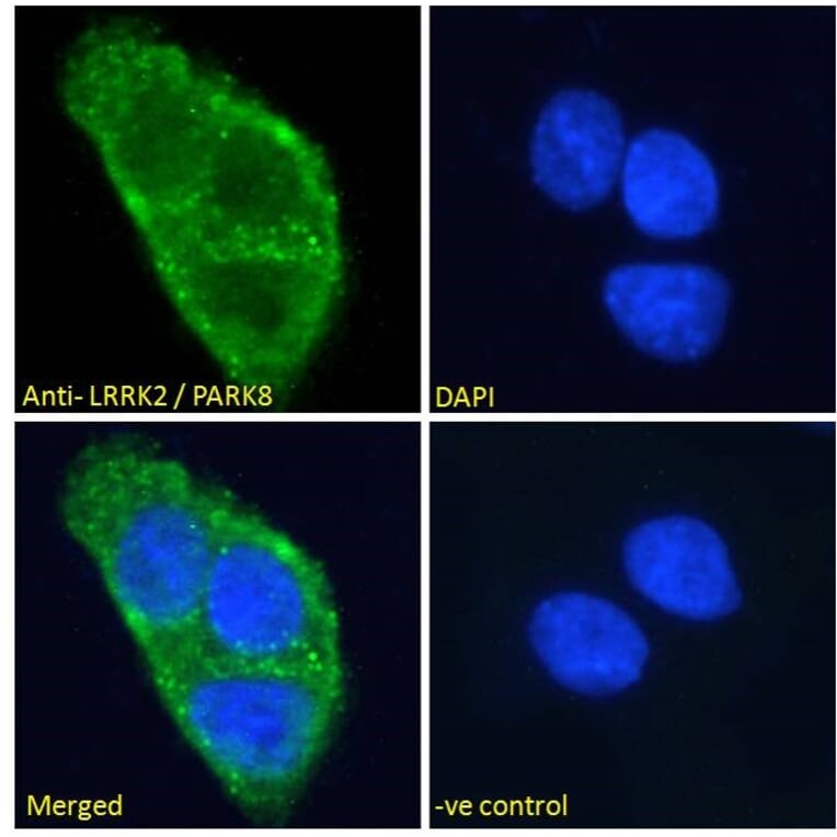 Immunofluorescence - Anti-LRRK2 Antibody (A84049) - Antibodies.com