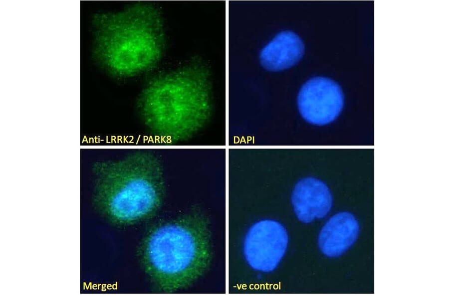 Immunofluorescence - Anti-LRRK2 Antibody (A84049) - Antibodies.com