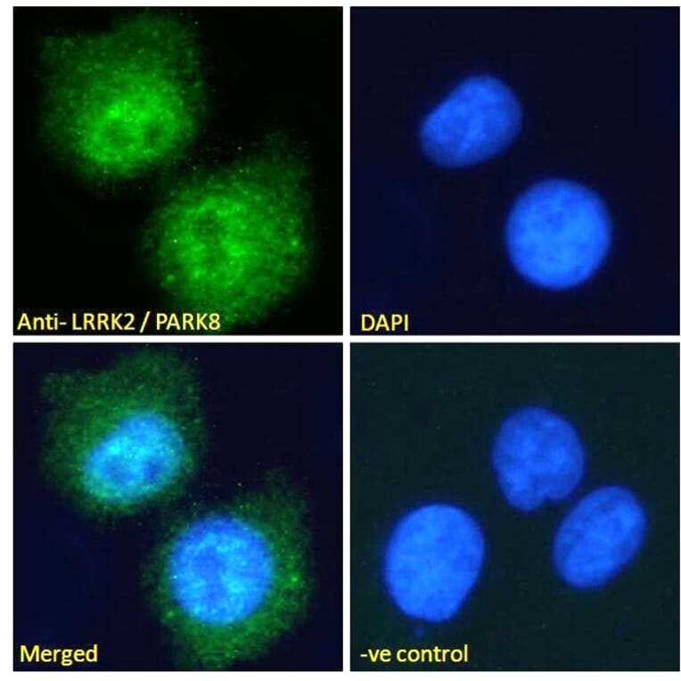 Immunofluorescence - Anti-LRRK2 Antibody (A84049) - Antibodies.com