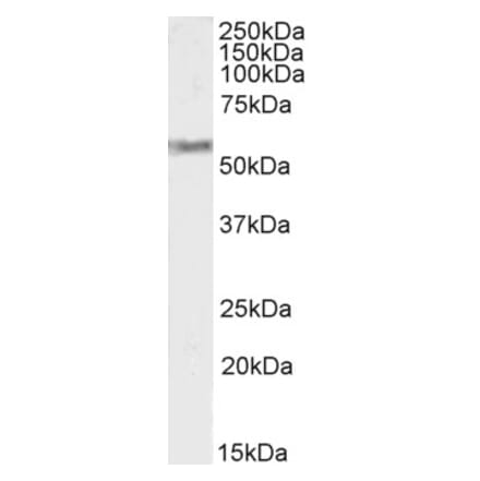 Western Blot - Anti-VMAT2 Antibody (A84050) - Antibodies.com