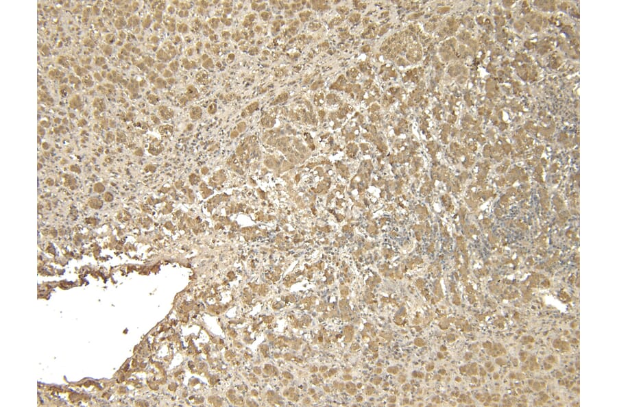Immunohistochemistry - Anti-VMAT2 Antibody (A84050) - Antibodies.com