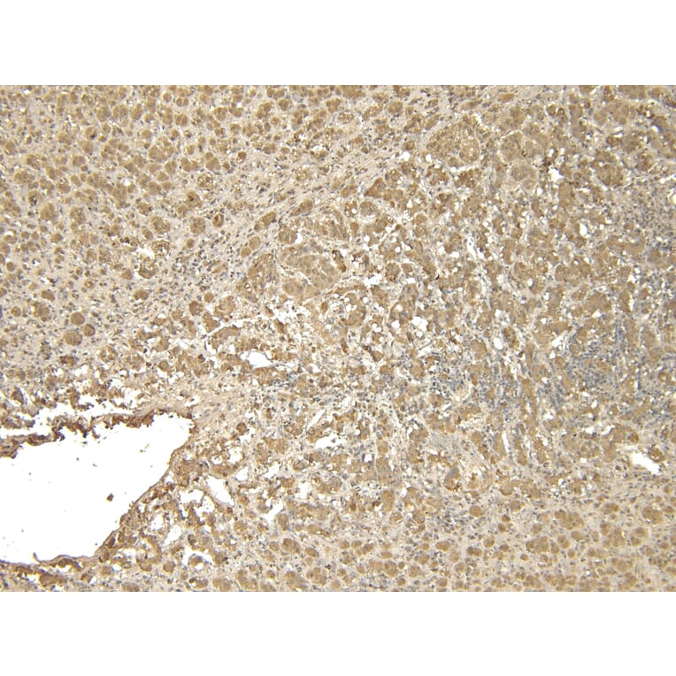 Immunohistochemistry - Anti-VMAT2 Antibody (A84050) - Antibodies.com