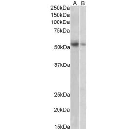 Western Blot - Anti-SLC18A2 Antibody (A84050) - Antibodies.com