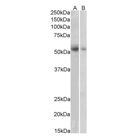 Western Blot - Anti-SLC18A2 Antibody (A84050) - Antibodies.com