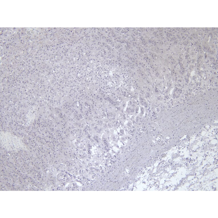 Immunohistochemistry - Anti-VMAT2 Antibody (A84050) - Antibodies.com