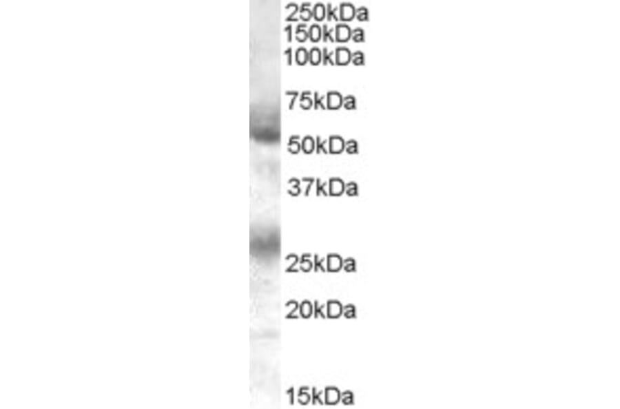 Western Blot - Anti-FLVCR1 Antibody (A84051) - Antibodies.com