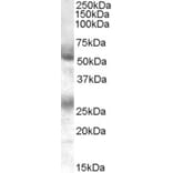 Western Blot - Anti-FLVCR1 Antibody (A84051) - Antibodies.com