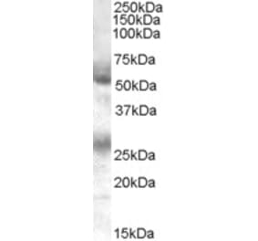 Western Blot - Anti-FLVCR1 Antibody (A84051) - Antibodies.com