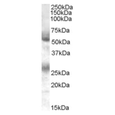 Western Blot - Anti-FLVCR1 Antibody (A84051) - Antibodies.com