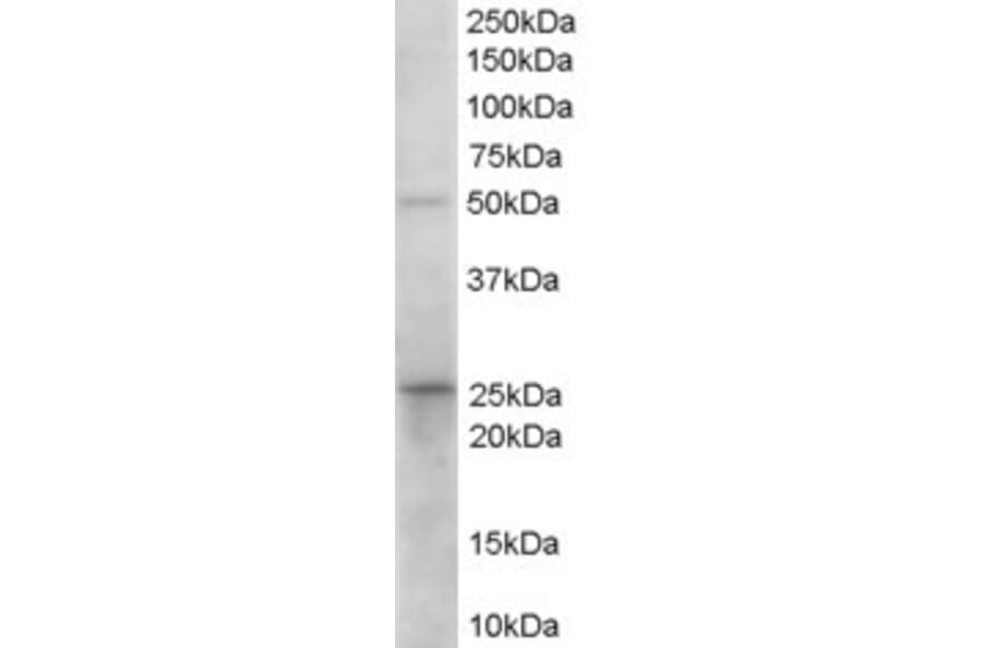 Western Blot - Anti-15PGDH Antibody (A84052) - Antibodies.com