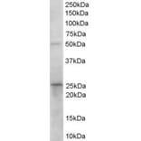 Western Blot - Anti-15PGDH Antibody (A84052) - Antibodies.com