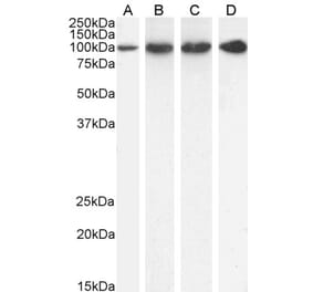 Western Blot - Anti-Proteasome 26S S2 Antibody (A84053) - Antibodies.com