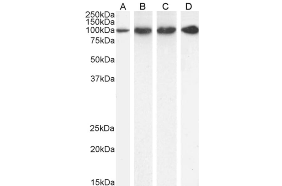 Western Blot - Anti-Proteasome 26S S2 Antibody (A84053) - Antibodies.com