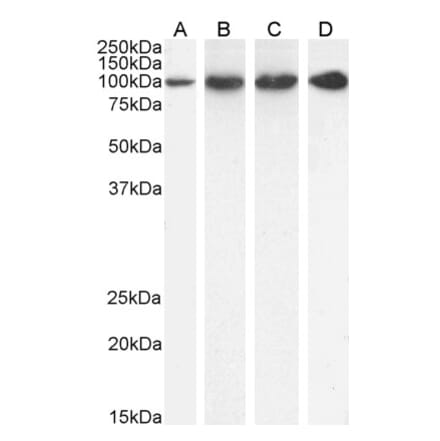 Western Blot - Anti-Proteasome 26S S2 Antibody (A84053) - Antibodies.com